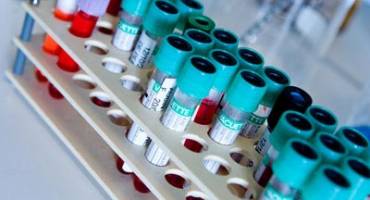 In Vitro Diagnostics Devices (IVDs)